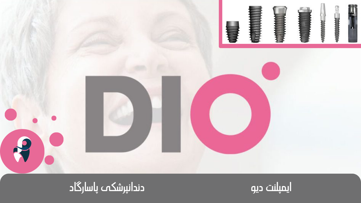 ایمپلنت دیو دندانپرشکی پاسارگاد ایمپلنت دیو dio implants